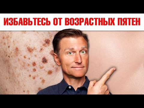 Возрастные пигментные пятна: РЕАЛЬНЫЕ причины и решение🙌