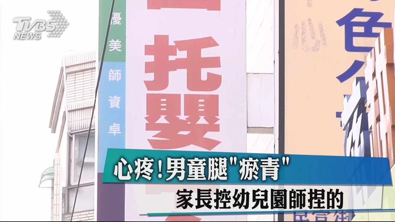 心疼!男童腿瘀青 家長控幼兒園師捏的