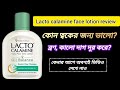 Lacto Calamine Face Lotion Review Lacto Calamine Face Lotion Review In Bengali