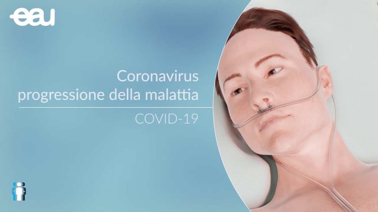 Watch Now Coronavirus COVID-19 - Progressione della malattia Coronavirus COVID-19 - Progressione della malattia