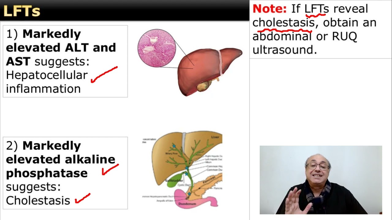 Liver Function Tests (LFTs)