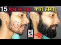 Beardo Hair Growth Oil After 15 Days Review Best Beard Oil For Patchy Beard In India 2022