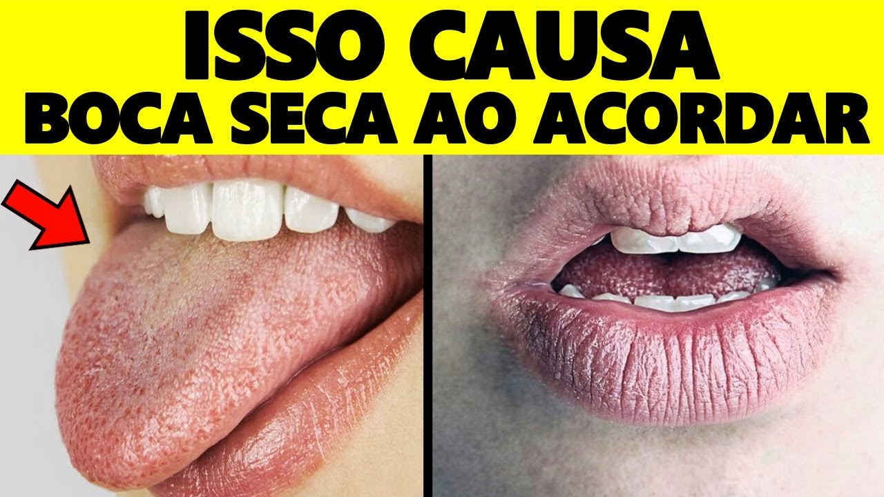 Por esse Motivo você fica com a BOCA SECA ao ACORDAR e COMO CURAR