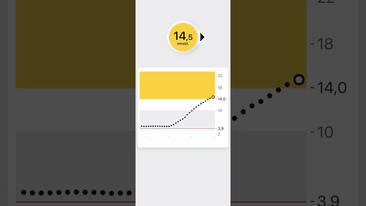 IAV alerts Dexcom ONE+ OUS lv MMOL