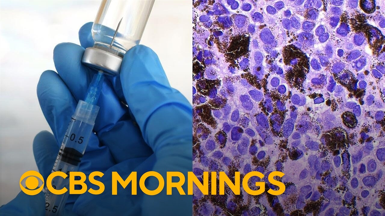 This mRNA vaccine could potentially prevent the deadliest form of skin cancer