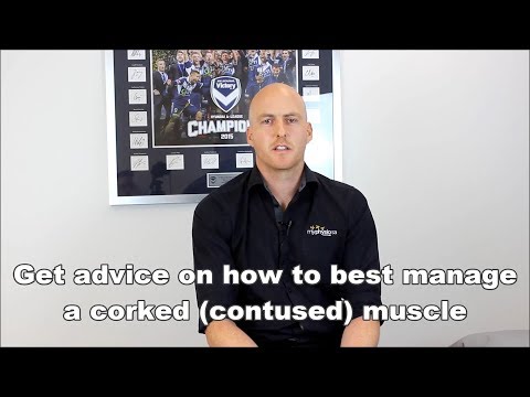 Corked bruised muscle advice by a Sports Physiotherapist Adelaide