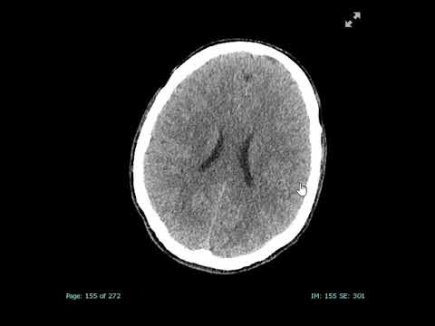 image-Can brain abnormalities be cured?