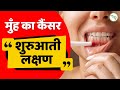 Signs Of Oral Cancer Hindi