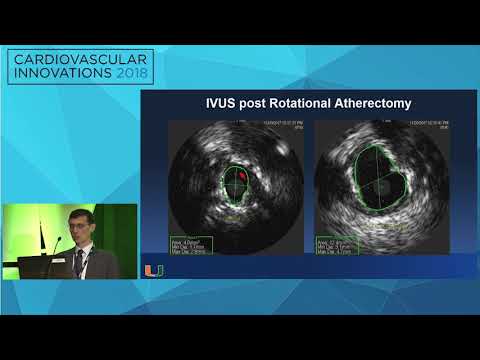 CVI2018 Session: Innovation in left main PCI - Mauricio Cohen, MD
