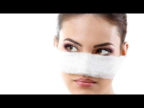 download lagu mp3 mp4 Kissing After Nose Job, download lagu Kissing After Nose Job gratis, unduh video klip Kissing After Nose Job