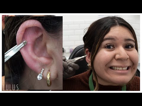 Removing An Earring That Was Stuck For 4 Years!! Video