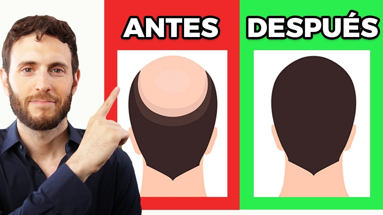 Cómo frenar la caída de pelo en hombres y mujeres