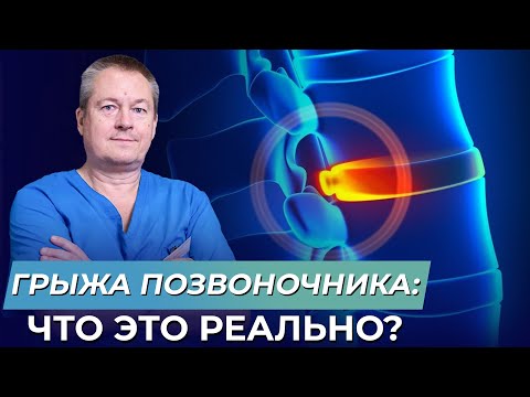Понятие о суставах связках и сухожилиях Причина болит голова на шее