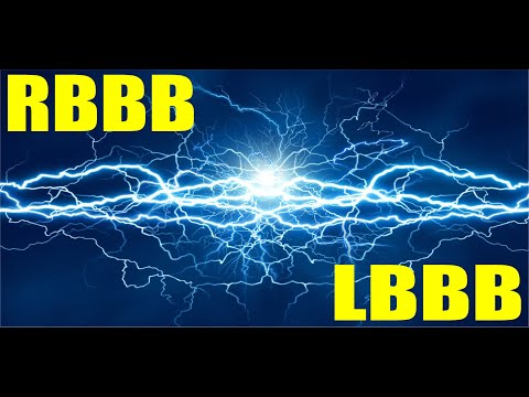 RBBB & LBBB: Bundle Branch Block Basics