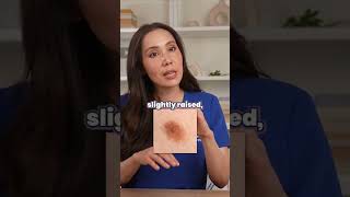 Download lagu All About Moles: Part I mp3 Download lagu All About Moles: Part I mp3