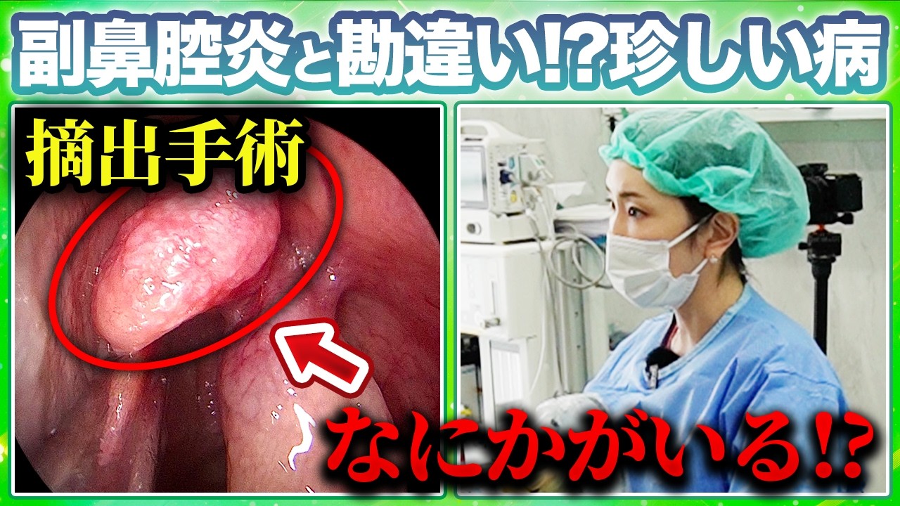 【手術解説】その鼻づまり、副鼻腔炎じゃないかもしれません。