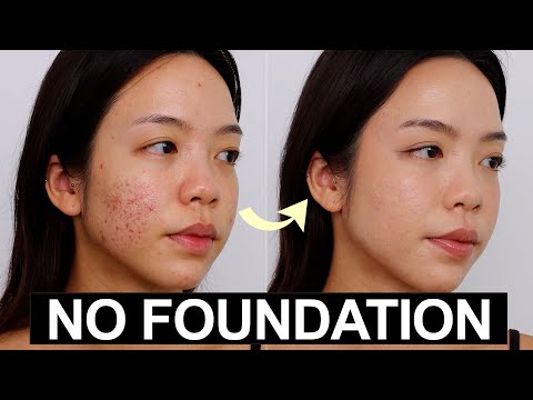 Clean girl makeup for acne skin (NO Foundation!) | how to cover acne naturally