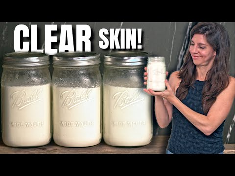 This Yogurt Changed My Life, SIBO, Rosacea