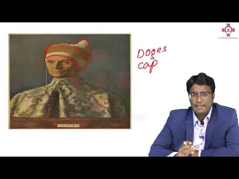 Signs in Pneumoperitoneum | Radiology