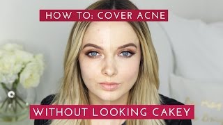 HOW TO: COVER ACNE & SCARS WITHOUT LOOKING CAKEY // MyPaleSkin