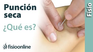 Qué es la punción seca y para qué se utiliza en fisioterapia.