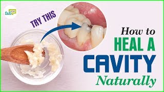 How to Get Rid of Cavities (Heal and Reverse)