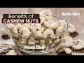 10 Amazing Benefits Of CASHEW NUTS