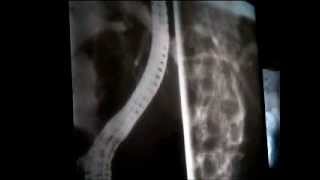 Surgical Radiology - 16 - Biliary System images 2