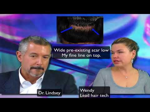 YET ANOTHER FUE REPAIR in DC by Dr. Lindsey | McLean | Virginia | Maryland thumbnail