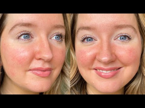 download lagu mp3 mp4 Rosex, download mp3 Rosex free download mp3, download mp3 Rosex