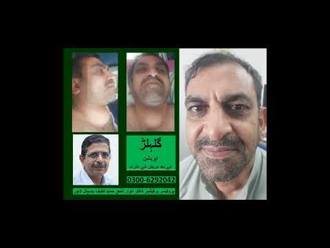 Thyroidectomy patient shares experience with Dr. Anwar ul Haq