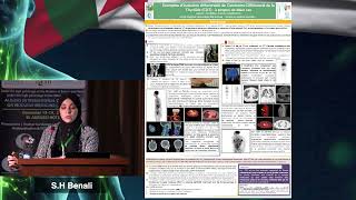 AICONM24 - Exemples d'évolution défavorable de Carcinome Différencié de la Thyroïde (S.H. BENALI)