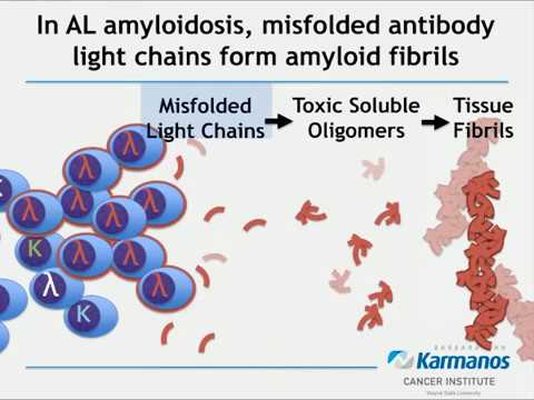 The Changing Paradigm of Amyloidosis Treatment