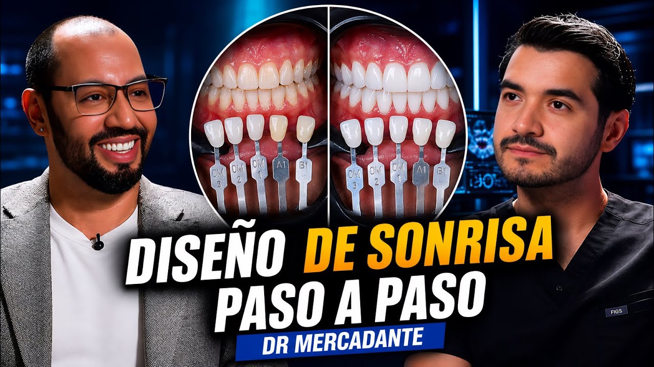 🚨¿Cómo Hago un DISEÑO DE SONRISA? TODO (Precio, Tiempo, Cerámica, Blanquear?)