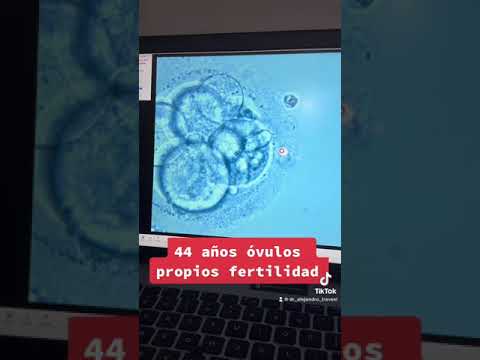Alejandro Travesi-6
