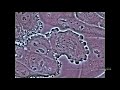 Mitosis In An Animal Cell Under The Microscope