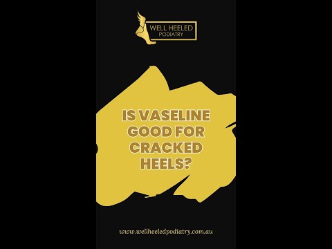 Is vaseline good for cracked heels?