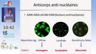 Pr A. Belot.  Quand doser les AC
