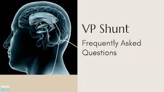 VP Shunt - Frequently Asked Questions