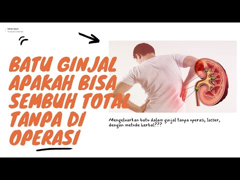 Batu Ginjal Apakah Bisa Sembuh Total Tanpa Di Operasi?