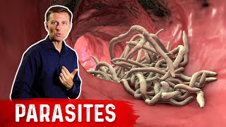 The Best Herbs for Parasites