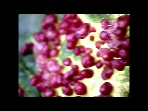 Disgusting parasitic mites Ultra close up