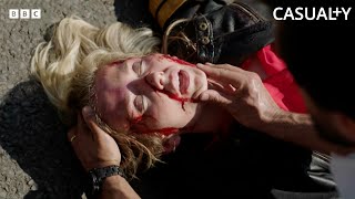 Hit By A Car At FULL Speed 😱 | Internal Affairs | Casualty