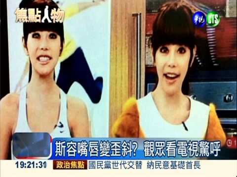 整型致唇歪臉癱? 斯容:角度問題