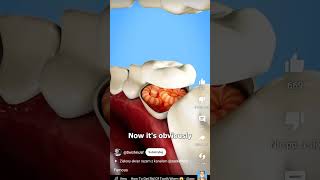 Download lagu bro thought he could hide 🫥 #memes #goofyahhmemes #voiceeffects #goofyahh #xd #stopgreenscreenkids mp3