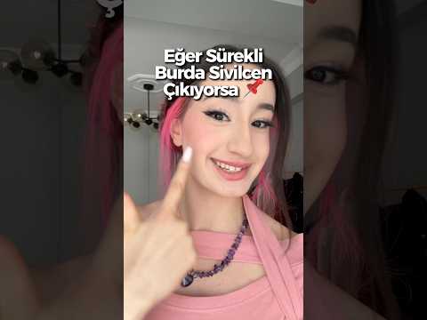 Burda sivilcen varsa yapman gerekenler 🙏🏻 Takip et! Beğen ❤️ İnternetteki kız kardeşinim