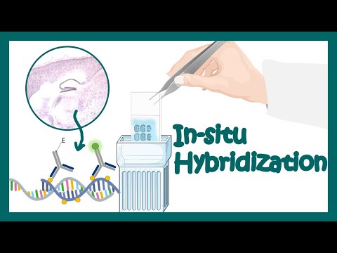 image-What are the nucleic acid hybridization techniques?