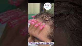 PDO Mono Threads For Hair Loss Treatment at Laser Aesthetics Clinic