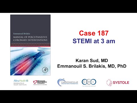 Case 187: Manual of PCI - STEMI at 3 am