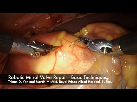 Surgical Videos - Tristan Yan